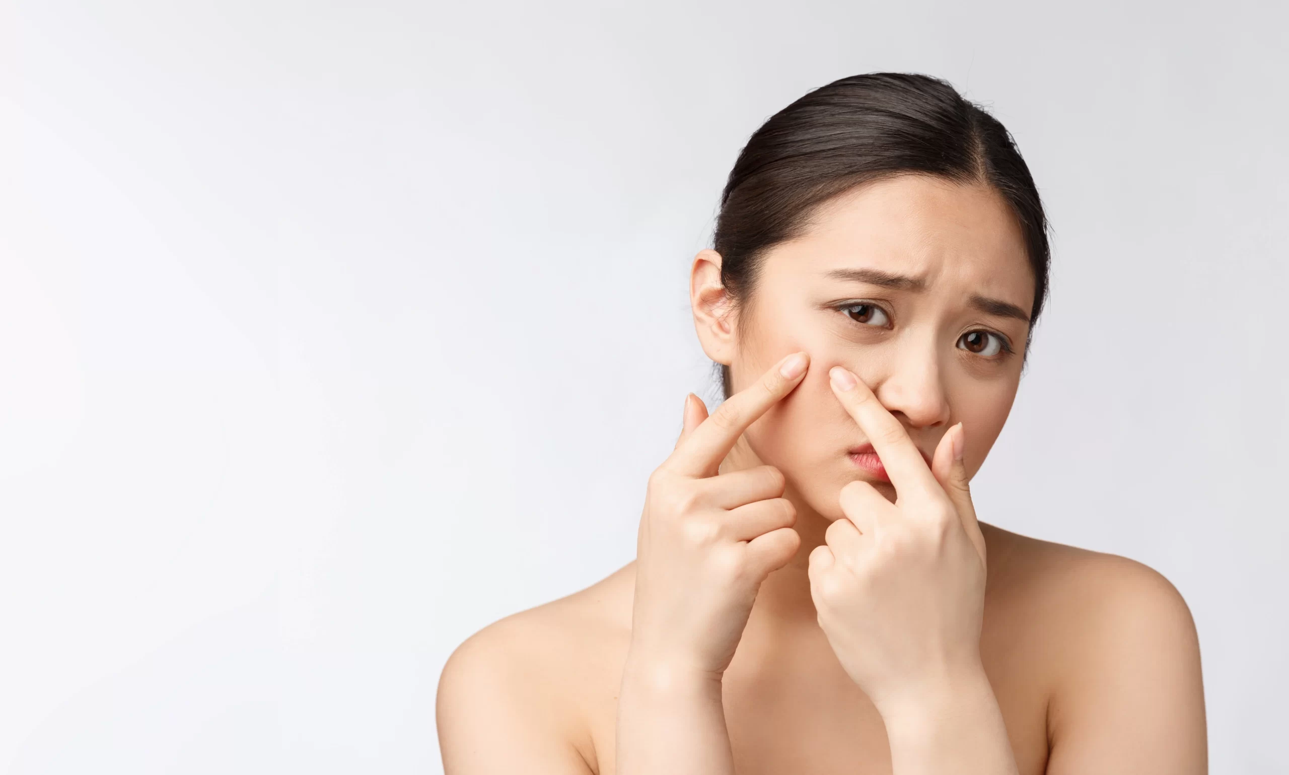 BLEMISHES GOT YOU DOWN? HERE ARE 10 HOME REMEDIES TO REMOVE BLEMISHES